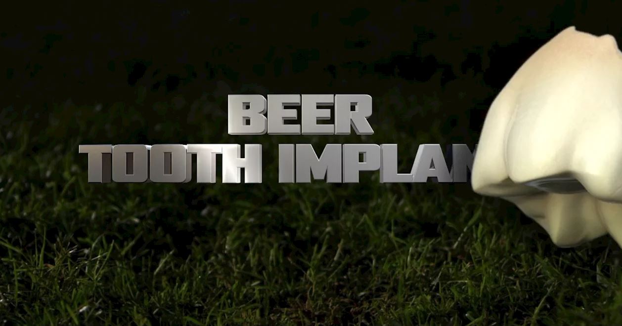 Beer Tooth Implant